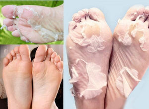 Baby Foot Deep Exfoliation for Feet Peel Socks